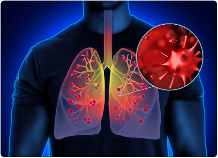 مواد غذایی برای افزایش اکسید نیتریک, نیتریک اکسید در چه غذاهایی است