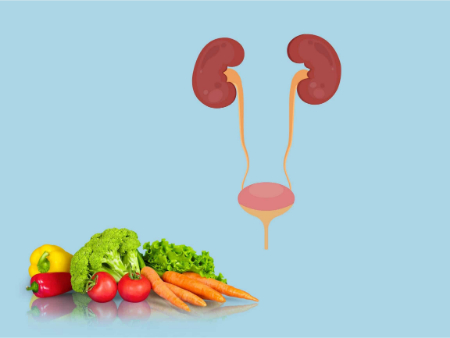رژیم غذایی سیستیت بینابینی؛ مزایا، معایب و برنامه غذایی