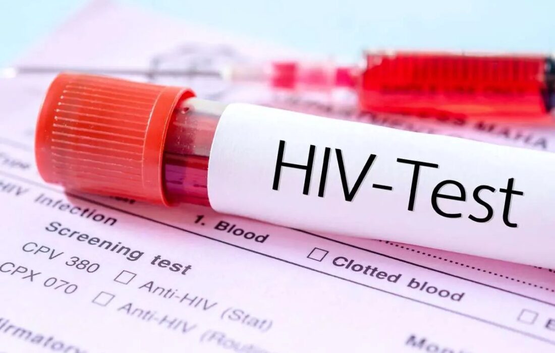 پیشرفت مهم در مسیر درمان «HIV» که پژوهشگران را شگفت‌زده کرد