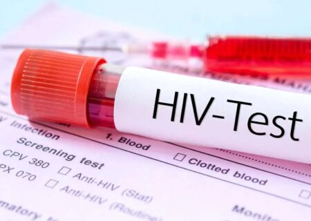 پیشرفت مهم در مسیر درمان «HIV» که پژوهشگران را شگفت‌زده کرد