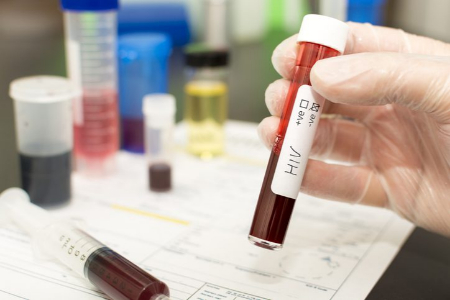 پیشگیری از HIV برای معتادان, پیشگیری از HIV