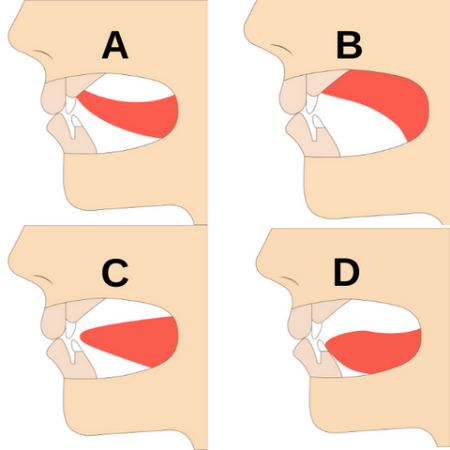 میوینگ, اموزش میوینگ فک