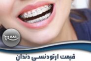قیمت ارتودنسی دندان با پرداخت اقساط