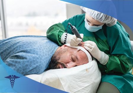 کاشت مو در شیراز؛ تجربه ای از اعتماد به نفس و زیبایی