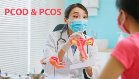تفاوت pcod و pcos, pcos چیست