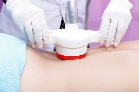 لاغری و خوش فرم کردن بدن با دستگاه rf