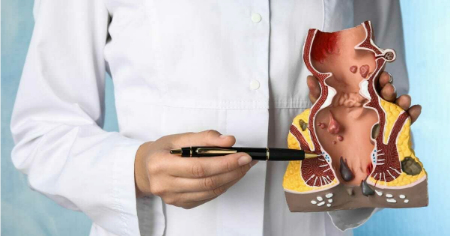 چرا بعد از اجابت مزاج احساس سوزش می‌کنم؟ علل و راه‌حل‌ها