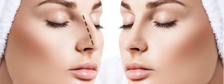 تفاوت جراحی بینی گوشتی و استخوانی؛ کدام برای شما مناسب‌تر است؟