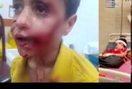 کودک ۱۱ ساله قربانی حمله ‌سگ‌های ولگرد شد