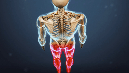 بی‌حسی کشاله ران, علت بی‌حسی در کشاله ران