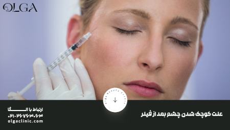 علت کوچک شدن چشم بعد از فیلر
