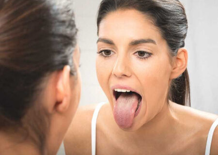 راز ترک‌های زبان؛ آیا زبان شیاردار خطرناک است؟