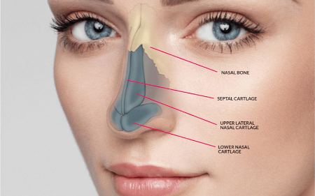 مدت زمان جوش خوردن استخوان بینی بعد از عمل (زمان دقیق)