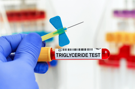 همه‌چیز درباره آزمایش تری گلیسرید TG؛ از تفسیر تا نکات کلیدی