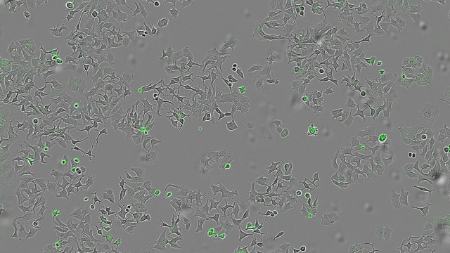 کشف امیدوارکننده دانشمندان اسپانیایی؛ پروتئینی که باعث «خودتخریبی سلول‌های سرطانی» ‏می‌‌شود