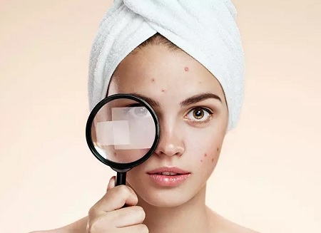 معرف انواع ماسک ضد لک و روشن کننده پوست خانگی