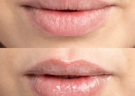 بهترین بالم لب برای پوست خشک؛ راهنمای جامع مراقبت