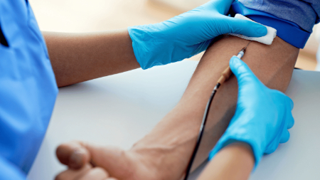 آزمایش CEA چیست, نتایج آزمایش CEA