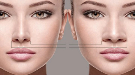 همه چیز درباره عمل بینی گوشتی؛ از انتخاب پزشک تا مراقبت‌های بعد از عمل
