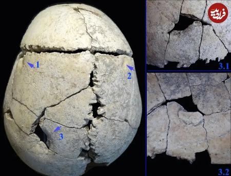 اسکلت،اخبار گوناگون،خبرهای گوناگون