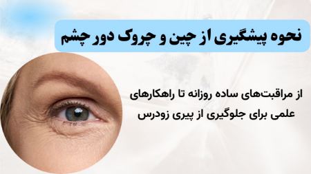کرم دور چشم