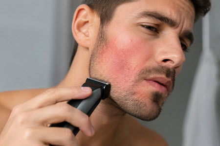 چرا بعضی ماشین‌های اصلاح باعث تحریک پوست می‌شوند؟ بررسی دلایل